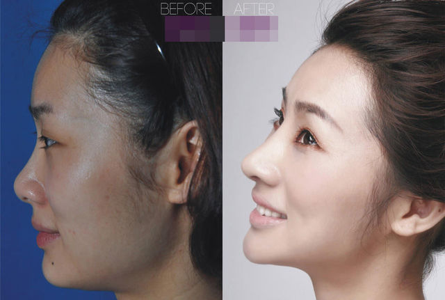 chirurgie-plastique-chine-02