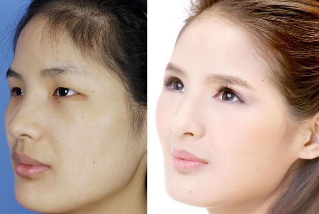 chirurgie-plastique-chine-03