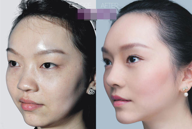 chirurgie-plastique-chine-05