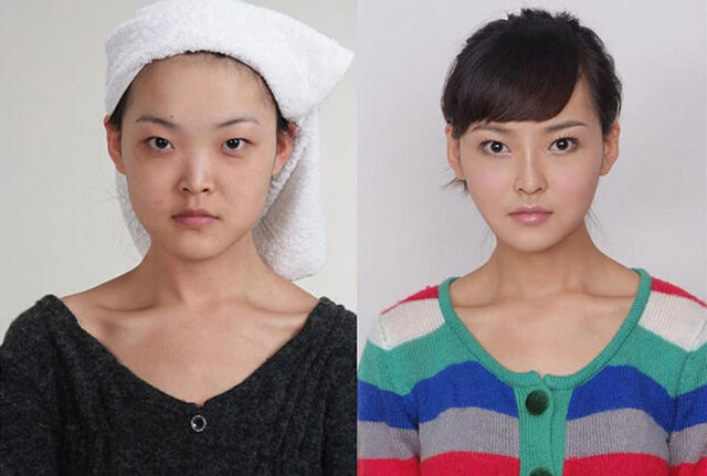 chirurgie-plastique-chine-06
