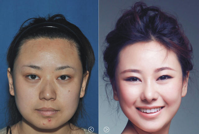 chirurgie-plastique-chine-07