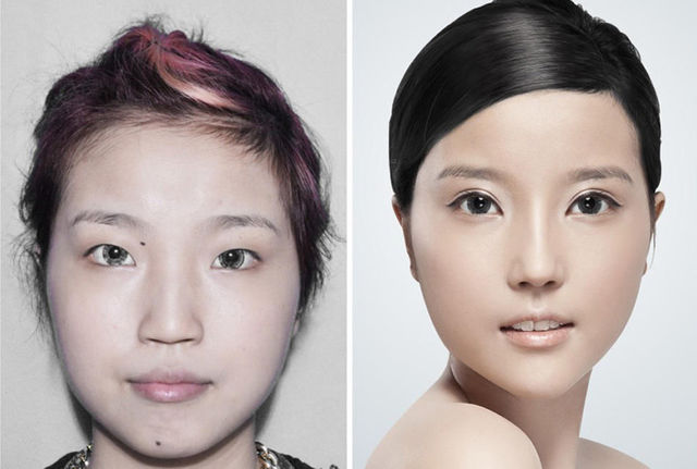 chirurgie-plastique-chine-10