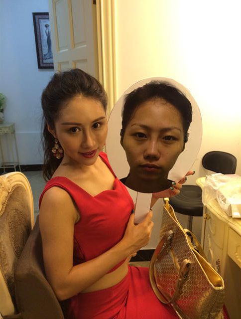 chirurgie-plastique-chine-11