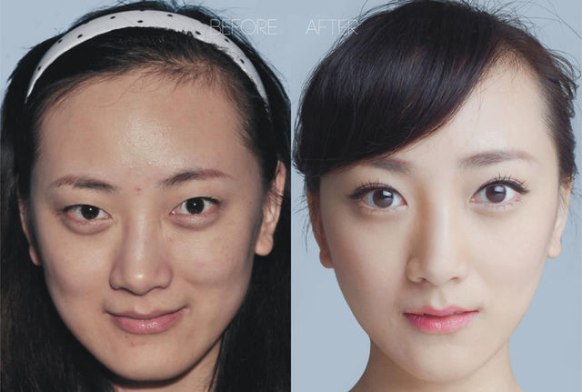 chirurgie-plastique-chine-12
