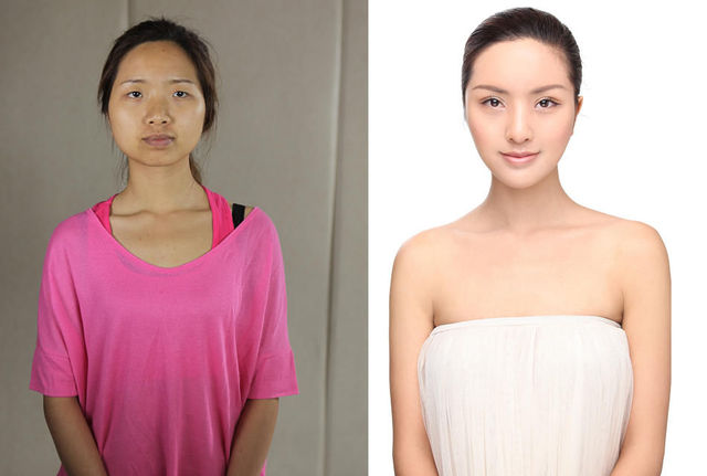 chirurgie-plastique-chine-16