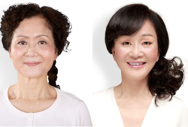 chirurgie-plastique-chine-17
