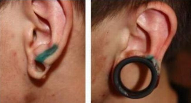 piercing-infection-03