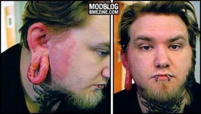 piercing-infection-08