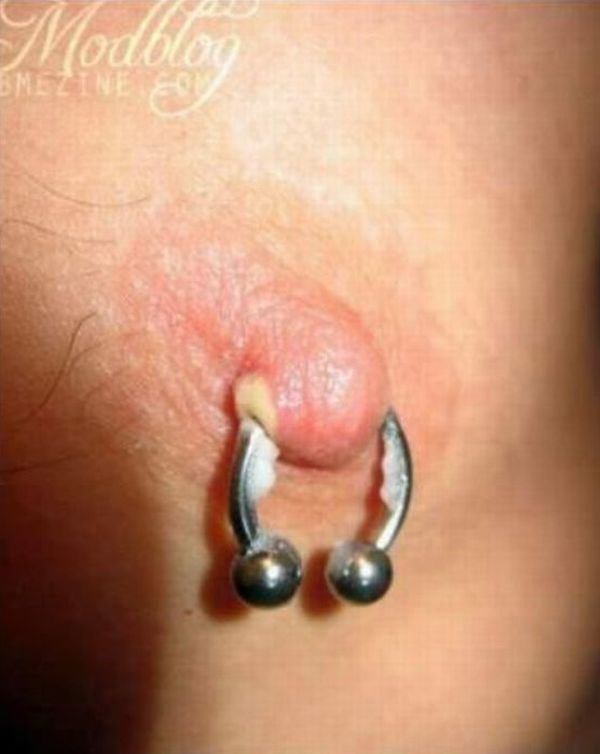piercing-infection-11