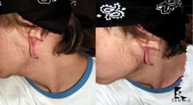 piercing-infection-35