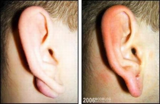 piercing-infection-36