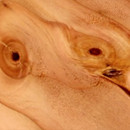 irm-tronc-arbre