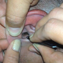 miniature pour Un papillon dans l'oreille