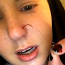 miniature pour Une fille gicle du sang en retirant le piercing de son nez