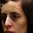 maladies-mortelles-peau