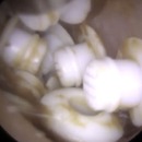 22-filtres-anti-cerumen-retires-oreille