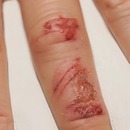guerison-blessure-doigt-timelapse