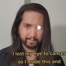 miniature pour Il remplace son oeil par une LED après un cancer
