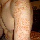 miniature pour Un bras tatoué par l'éclair