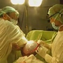 miniature pour Elle se fait retirer un kyste de 16kg du ventre