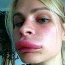 miniature pour Une alternative naturelle au botox